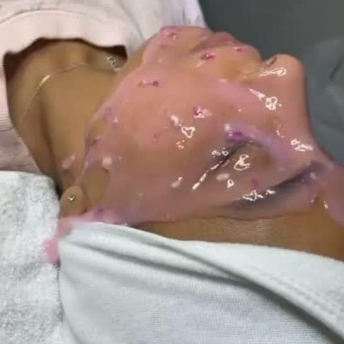 Hydrafacial Image 1 Hydrafacial Image 1