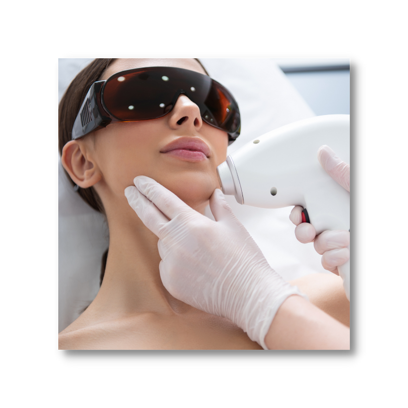 Laser Hair Removal in Milford