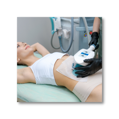 A coolsculpting patient in Milford MA during a fat freezing session.