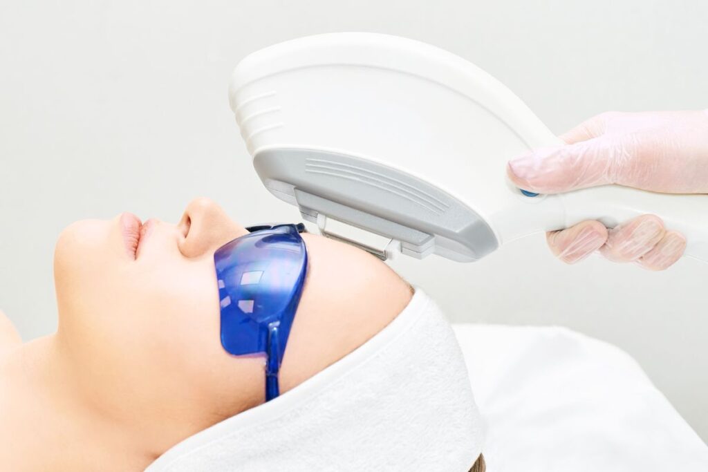 The lady undergoes photofacial treatment.