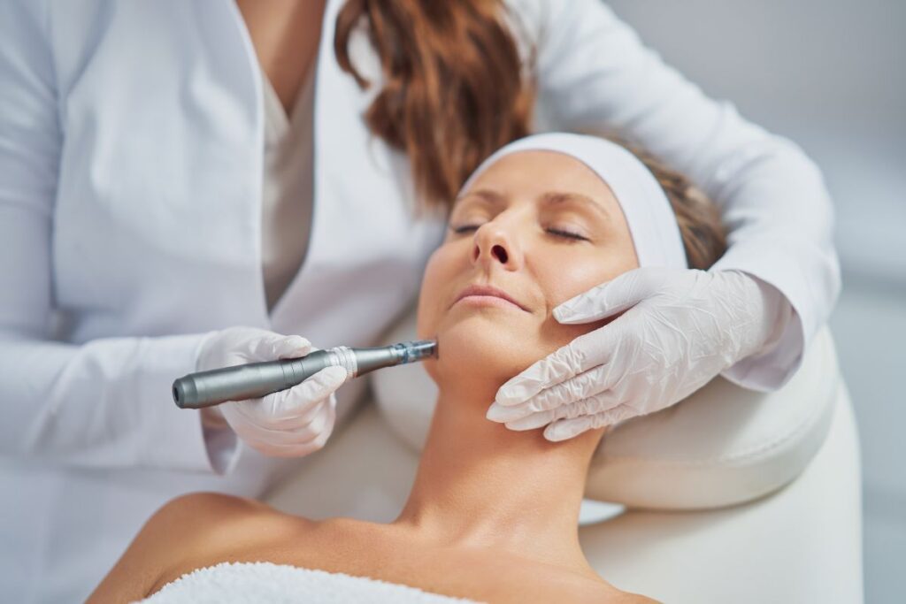 The woman is undergo microneedling for scars.