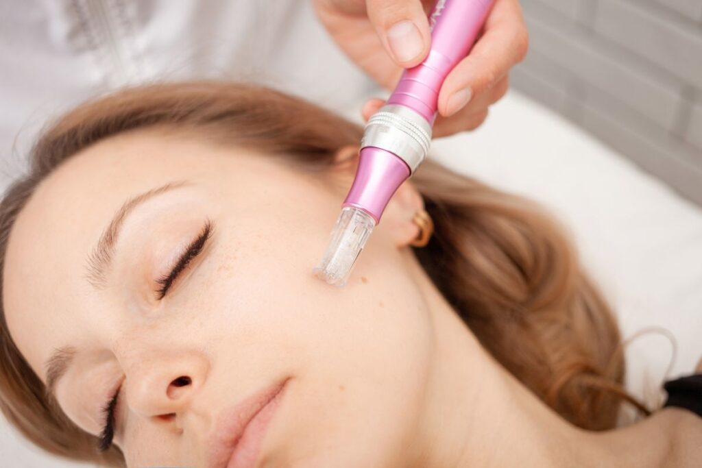 Microchanneling vs Microneedling: Which is Better?