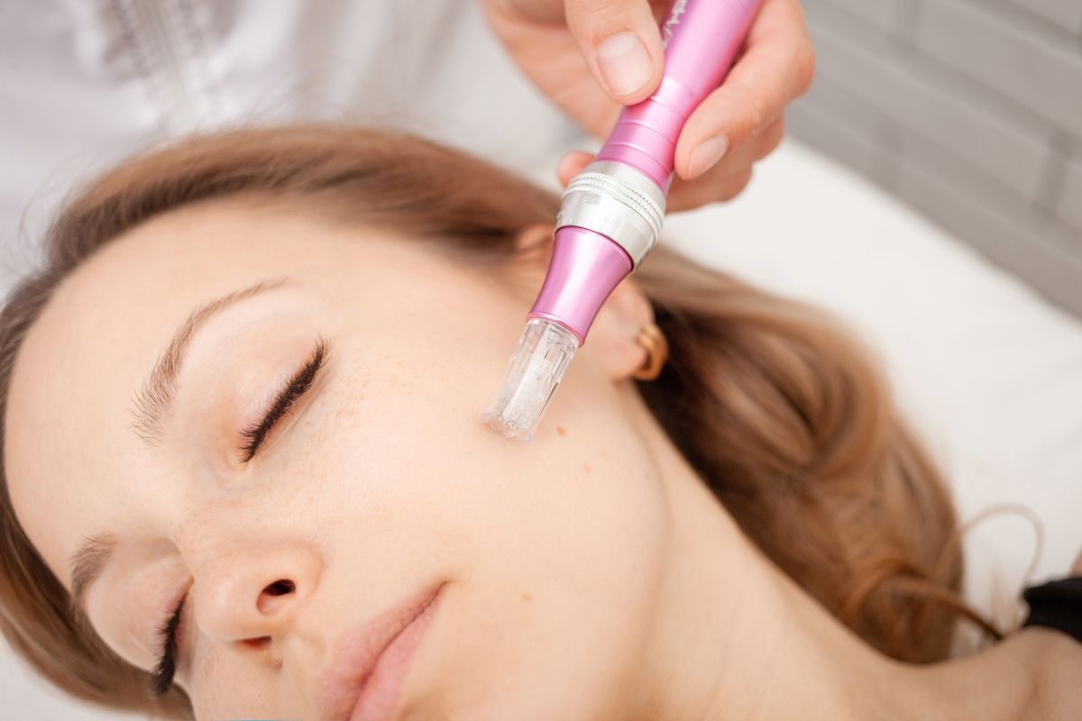 Microchanneling vs Microneedling: Which is Better?